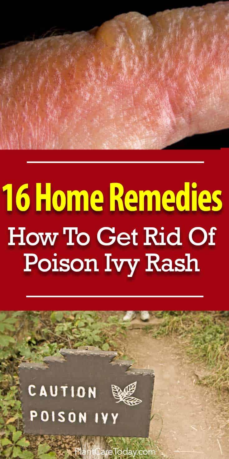 16 Home Remedies: How To Get Rid Of Poison Ivy Rash